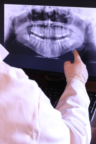 Best Emergency Root Canal Treatment in Freeman, SD