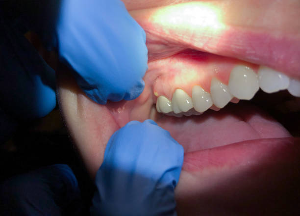 Best Pediatric Emergency Dentist in Freeman, SD