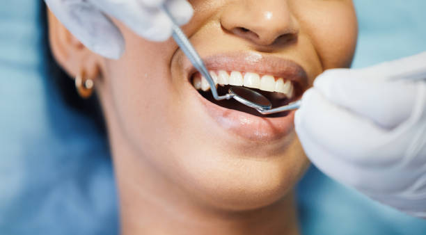 Best Emergency Wisdom Teeth Removal in Freeman, SD